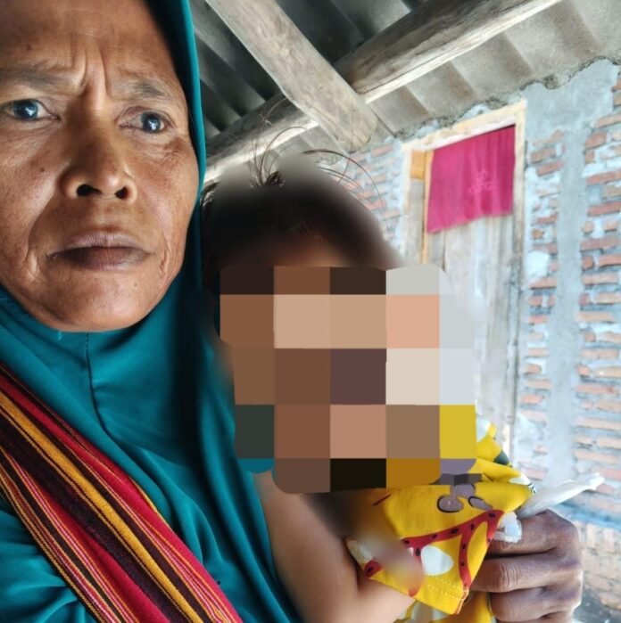 Bolak-balik Berobat, Balita Penderita Sakit Mata Berat di Lobar Butuh Penanganan