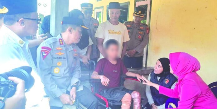 Jenguk Santri Korban Dugaan Pembakaran, Kapolda NTB Pastikan Proses Hukum Tetap Berjalan