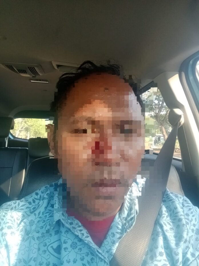 Pengemudi Taksi Diduga Dianiaya Saat Jemput Penumpang di Kawasan Mandalika